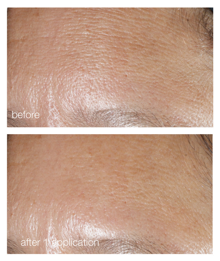 Dynamic skin retinol serum